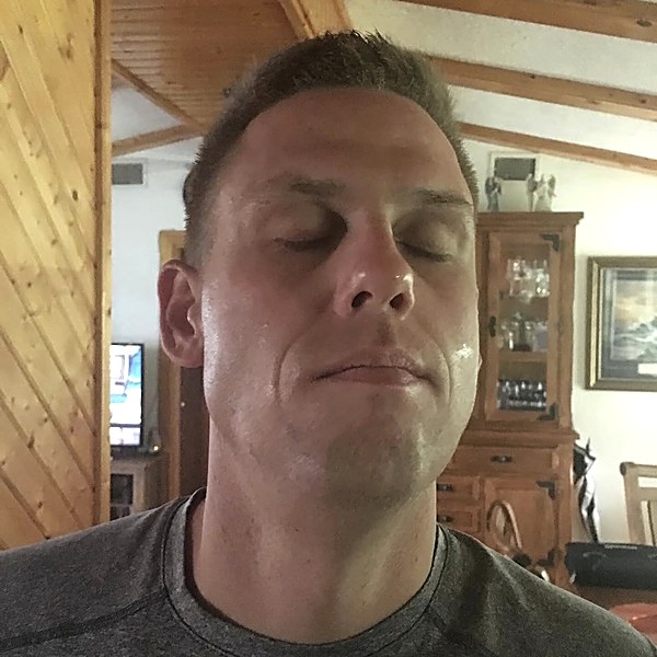 Facial burn after recovery